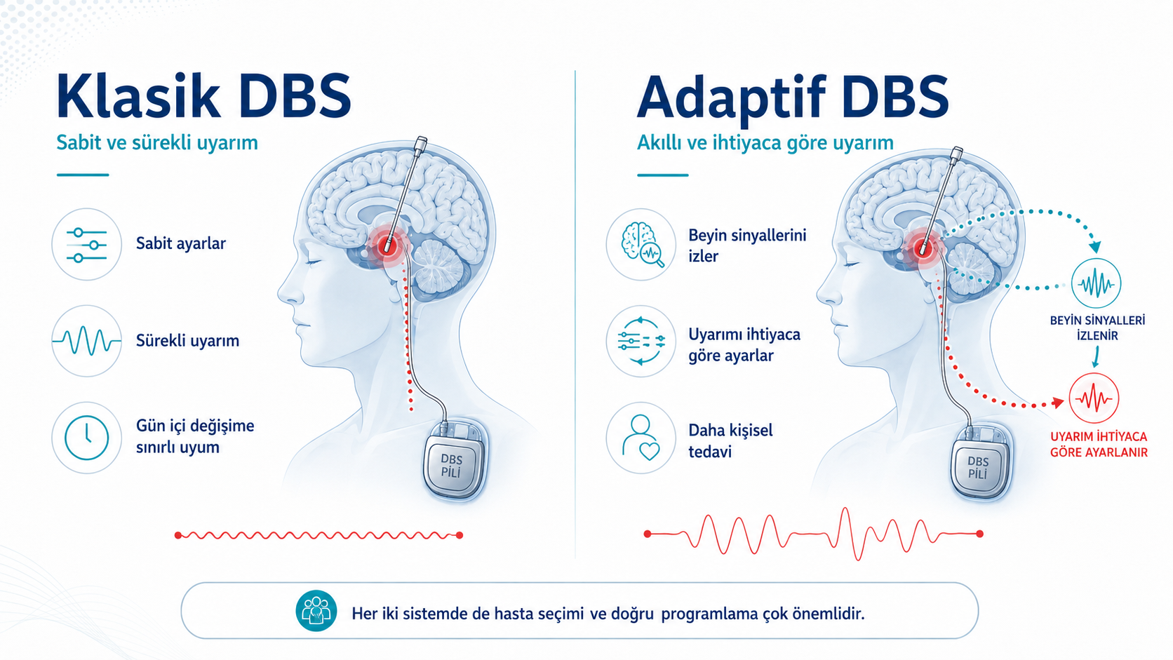 Beyni Dinleyen Yeni Nesil Beyin Pili: Adaptif DBS