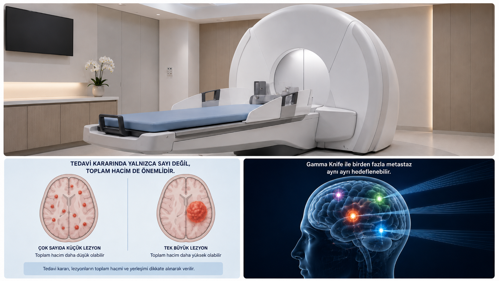 Birden Fazla Metastaza Gamma Knife uygulanır mı?